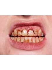 Kryolan Tooth Enamel 12ml