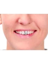 Kryolan Tooth Enamel 12ml